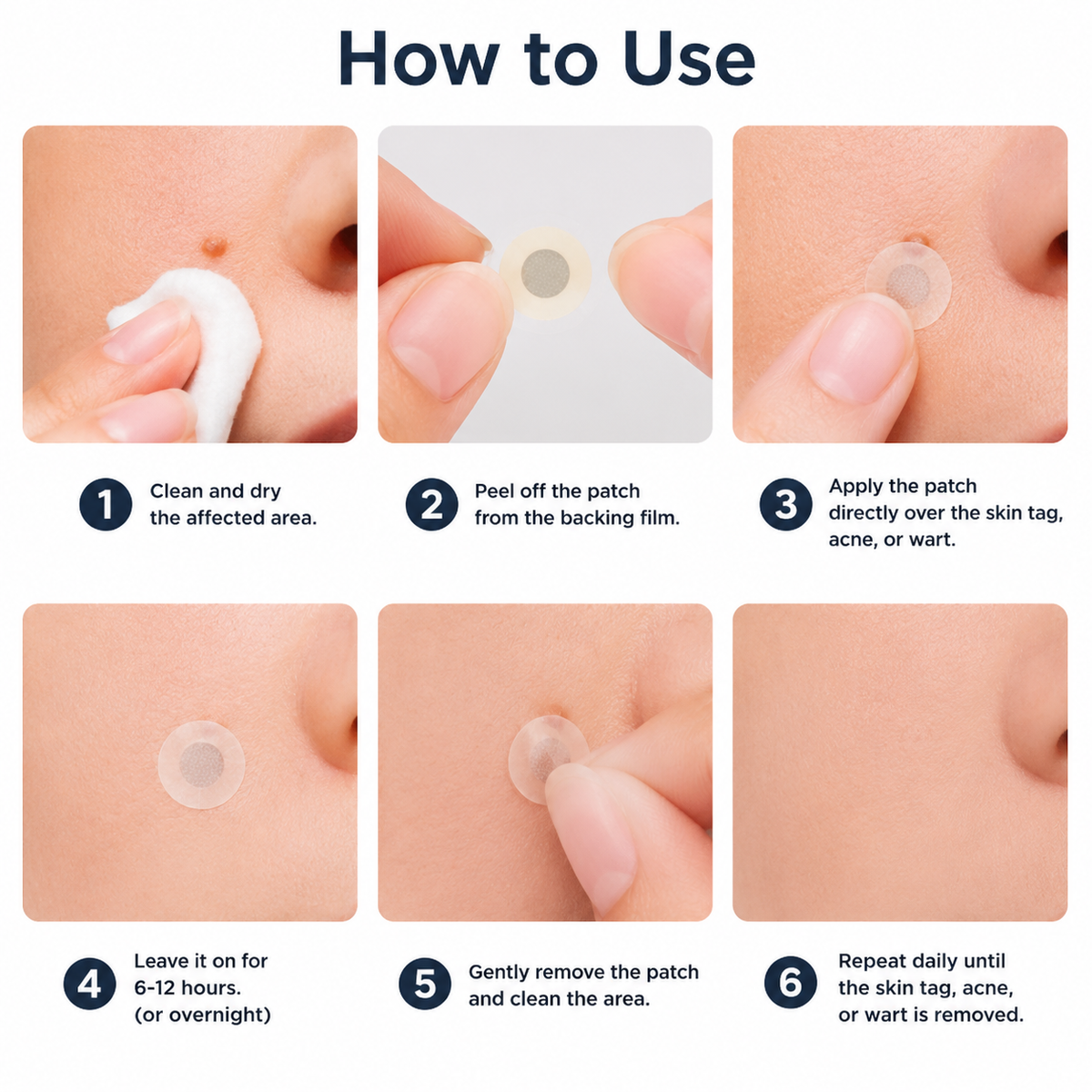 🔥 Curalona®2-in-1 Microneedle & Hydrocolloid Patch🔥| Removes Raised Moles, Acne, Flat Warts & Skin Tags | Helps Improve Wrinkles, Scars & Blemishes | Invisible Patches for Face & Body.