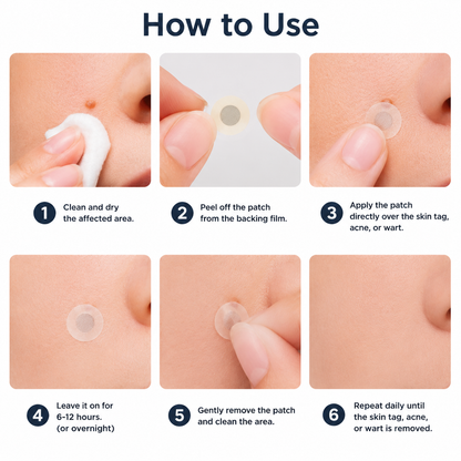 🔥 Curalona®2-in-1 Microneedle & Hydrocolloid Patch🔥| Removes Raised Moles, Acne, Flat Warts & Skin Tags | Helps Improve Wrinkles, Scars & Blemishes | Invisible Patches for Face & Body.
